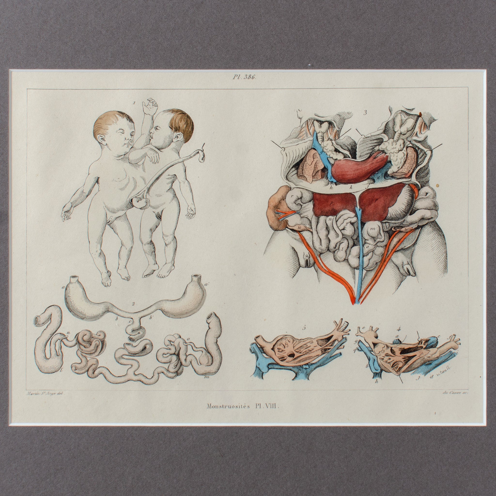 Monstruosites, Engravings from Isidore Geoffrey Sainte-Hilaire, Paris c. 1832